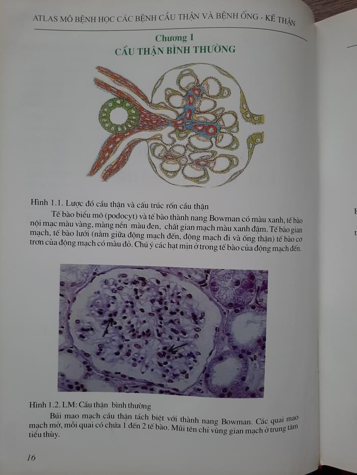 Cầu thận bình thường Sách Atlas Mô bệnh học - Các bệnh cầu thận và bệnh ống - kẽ thận