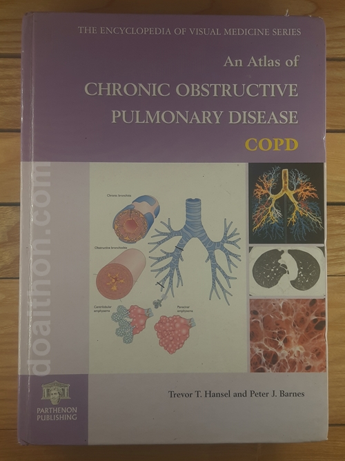 Atlas Chronic Obstructive Pulmonary Disease 1
